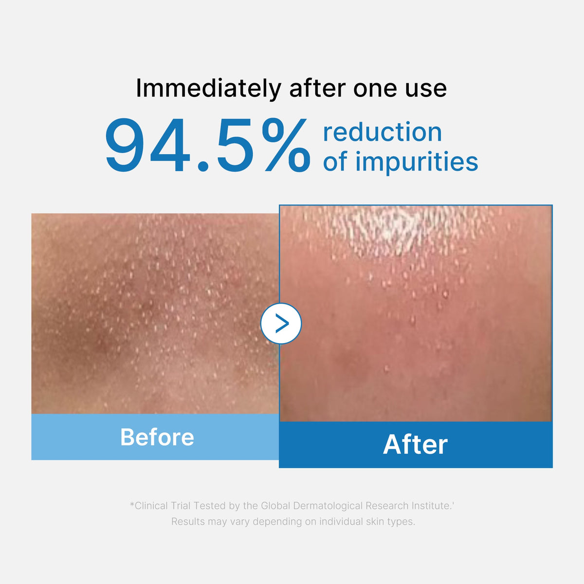 zero-pore-blackhead-deep-cleansing-oil-q5 01_eed557ec-5857-46a2-8b17-dbd67c692dcb.jpg