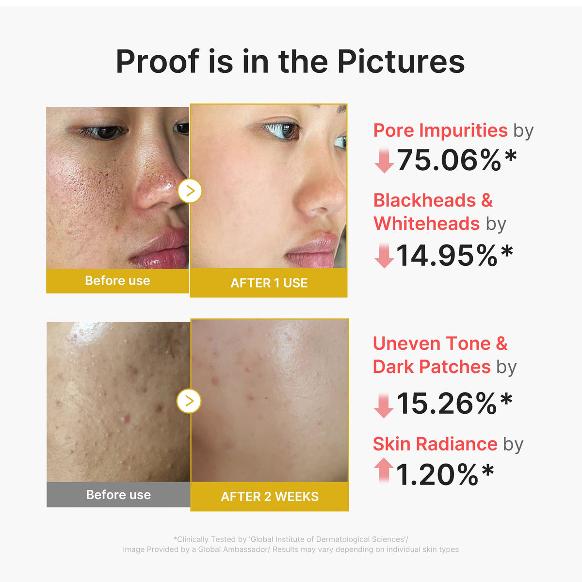kojic-acid-turmeric-peel-shot-p7 02_45fe66d3-b3f6-4100-aa52-2afd7eded417.jpg