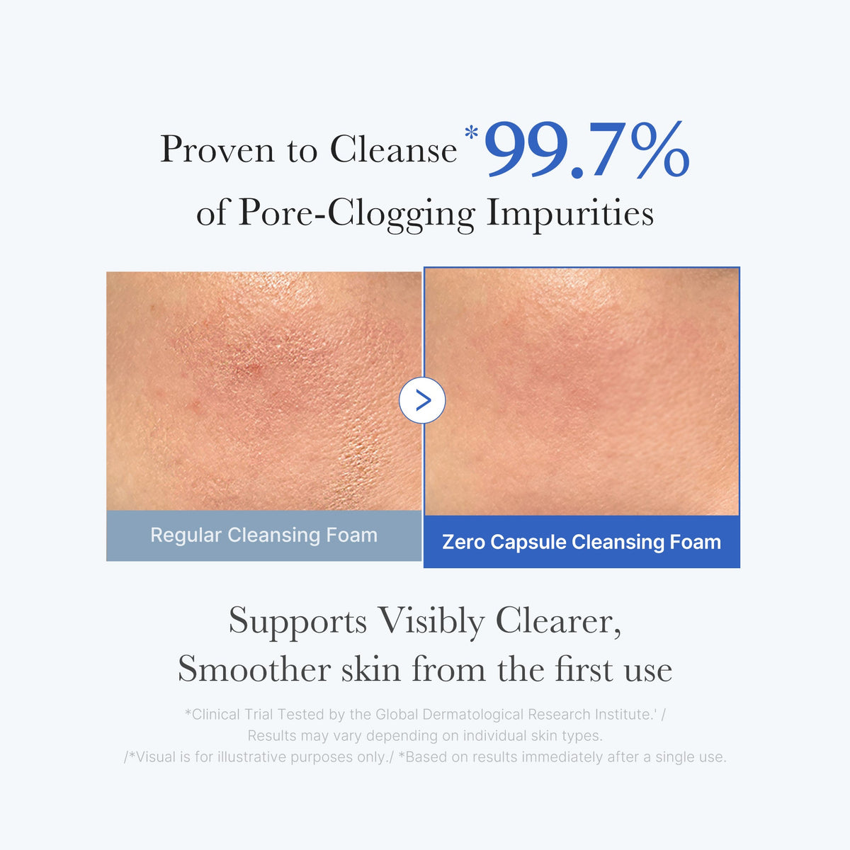 zero-pore-capsule-cleansing-foam-b5 02_c1fb9dfb-86c5-4038-8ff8-490d1006276c.jpg