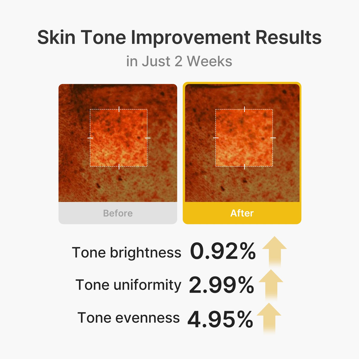 kojic-acid-turmeric-vita-capsule-cream-g9 03_2b626701-fc6c-4702-9e96-a2157a4f7f9d.jpg
