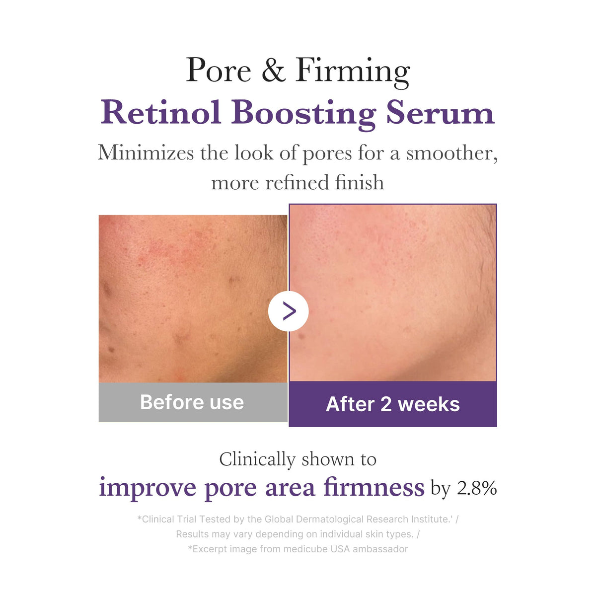 retinol-nmn-boosting-serum-e9 03_3510e7a5-5633-4a18-81ea-1389593bd517.jpg