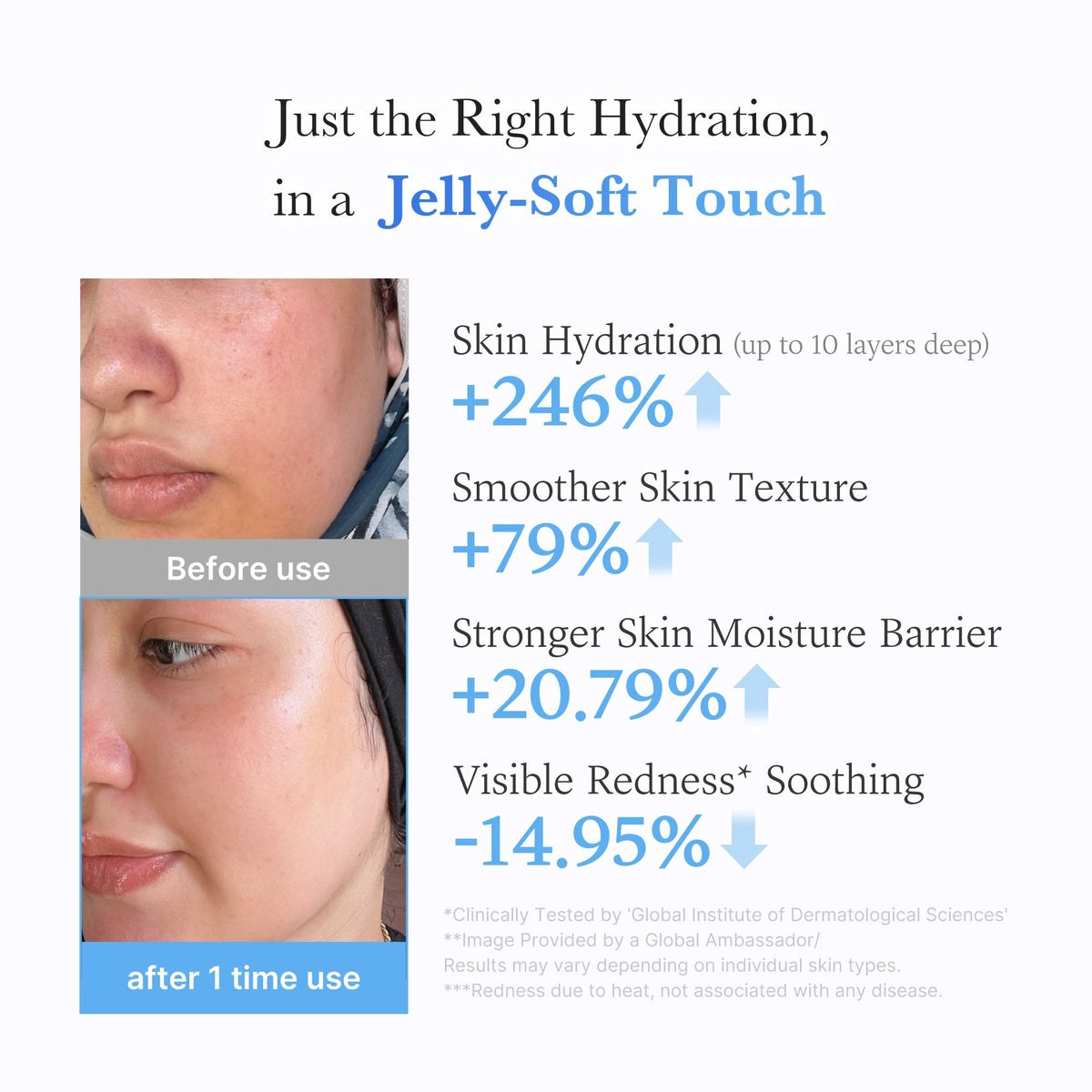hyaluronic-ceramide-moisturizing-jelly-cream-u7 03_c39d66cc-0839-4e48-ab4a-d32143d06b1c.jpg