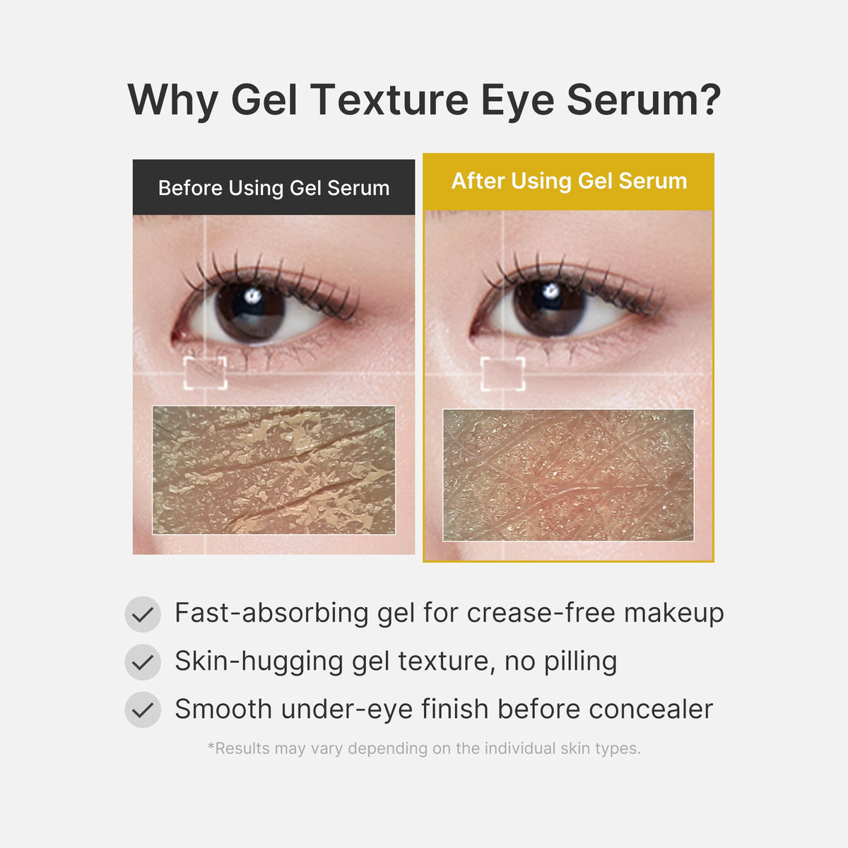 kojic-acid-tumeric-eye-gel-serum-j7 04_0487ef36-49f4-4294-8049-bb55118b05fe.jpg