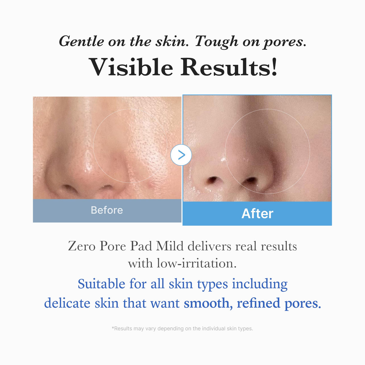 zero-pore-madecassoside-pads-mild-b8 04_6357f9f9-483b-4891-82c6-a58d336e62c8.jpg
