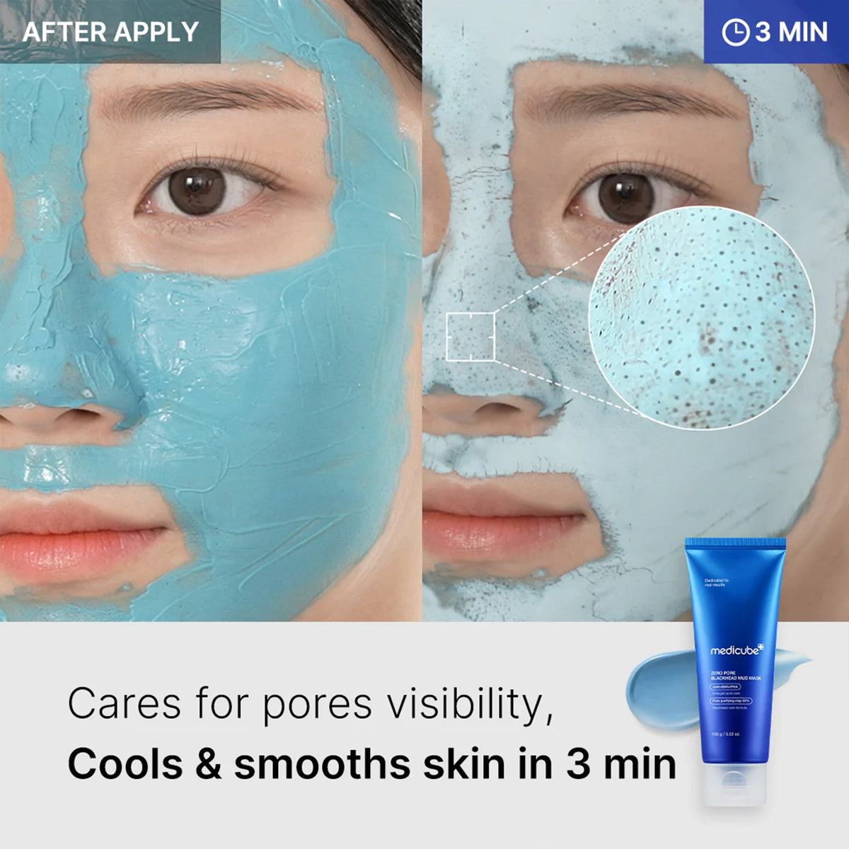 zero-pore-blackhead-mud-mask-q2 04_867c0459-a94e-40d3-bd9a-70400edabe8d.jpg