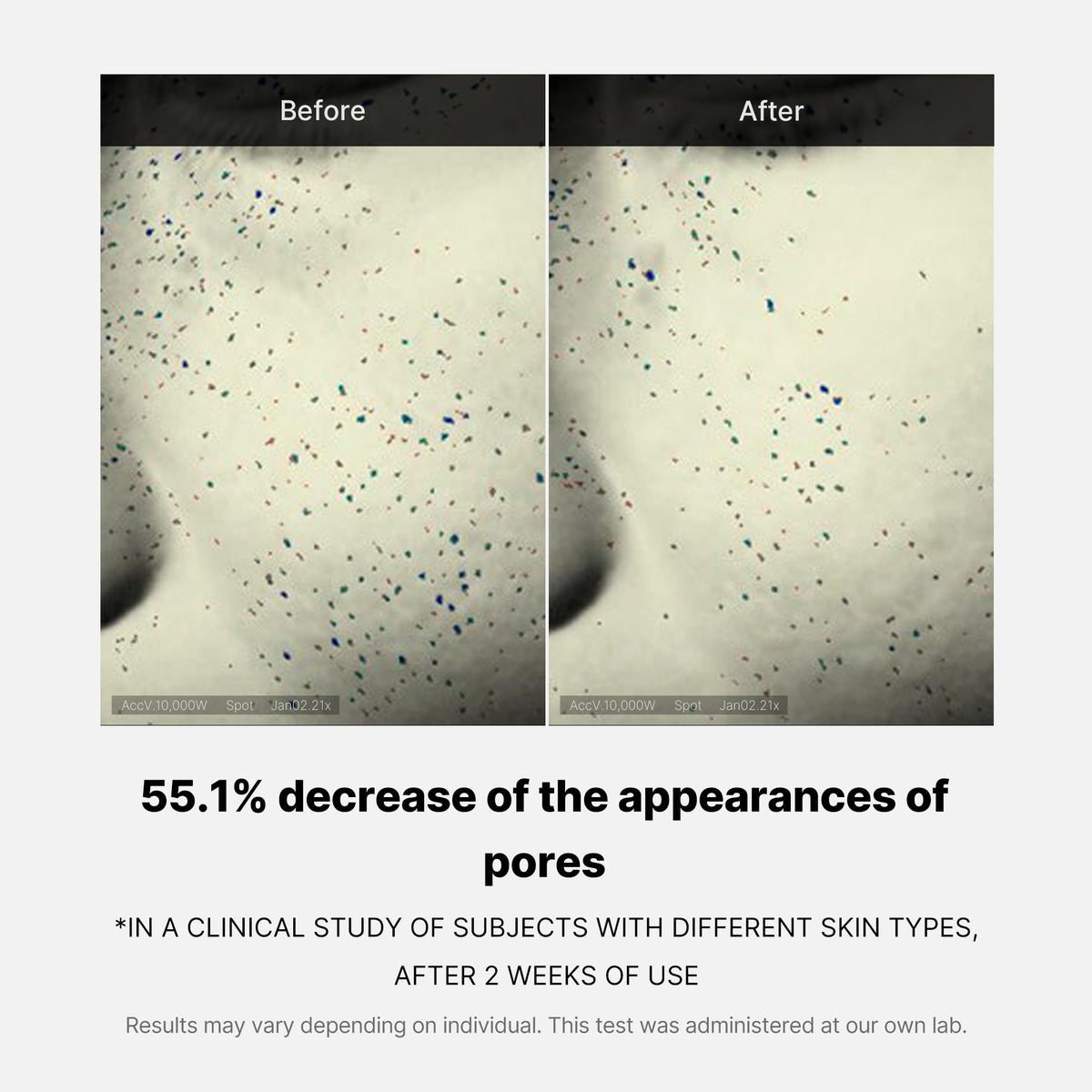 pore-care-duo-z5 05_12ddab8a-64be-4612-8ee1-27e5ec701921.jpg