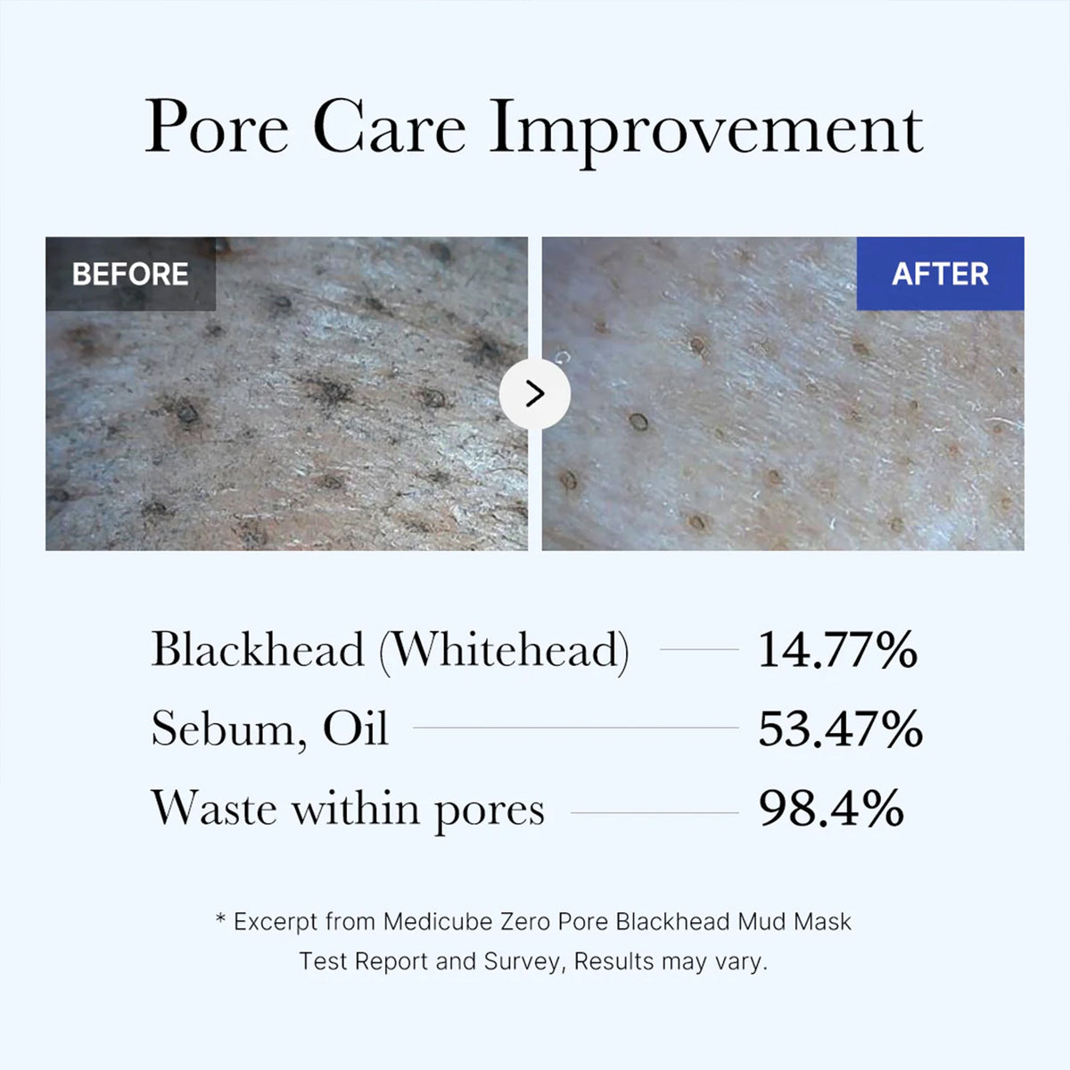 zero-pore-blackhead-mud-mask-q2 05_9362a158-c2b3-4525-acc0-631a2cfdea47.jpg