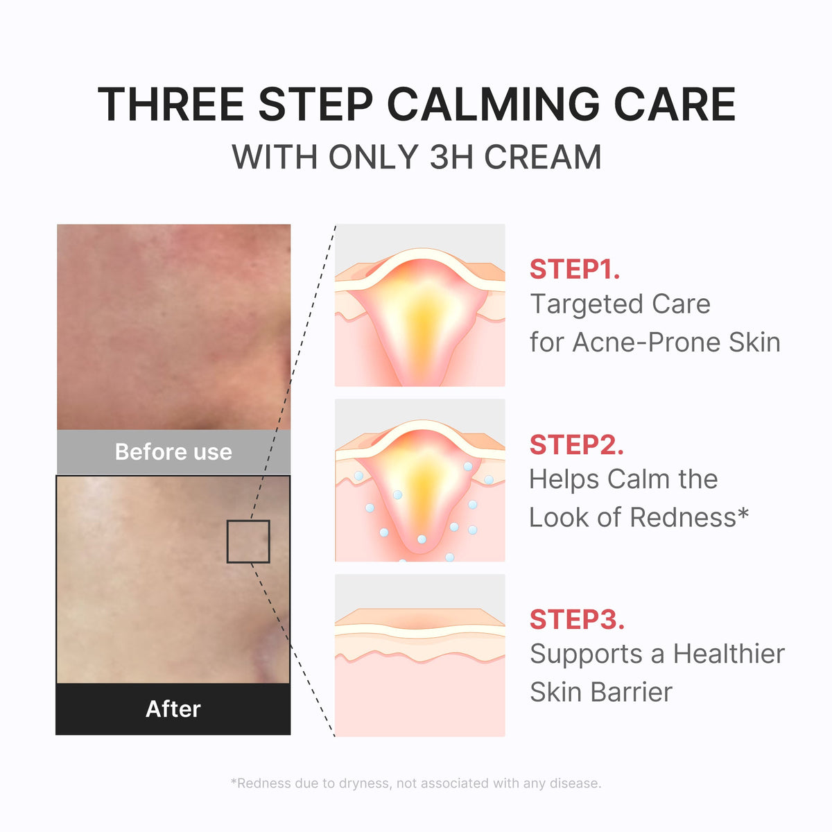 3h-daily-relief-cream-t9 3H_04.jpg
