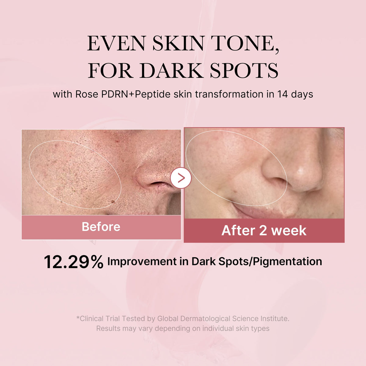 pdrn-pink-peptide-toner-l1 PDRN_01_308c518e-5ac6-4e54-99bd-eabc8796739b.jpg