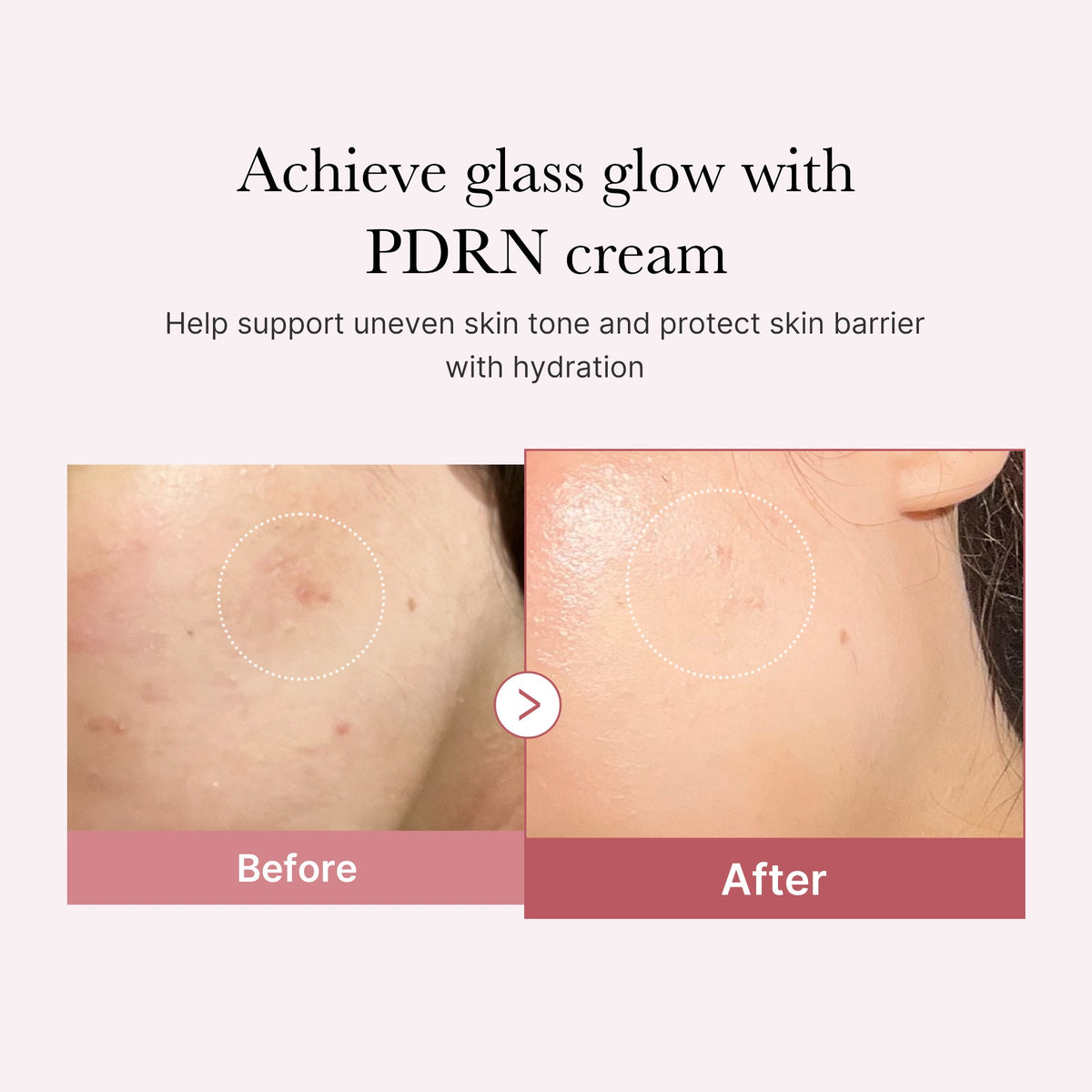 pdrn-pink-peptide-cream-e4 PDRN_02_d7805bfe-cf43-446a-b71b-a276683f136b.jpg