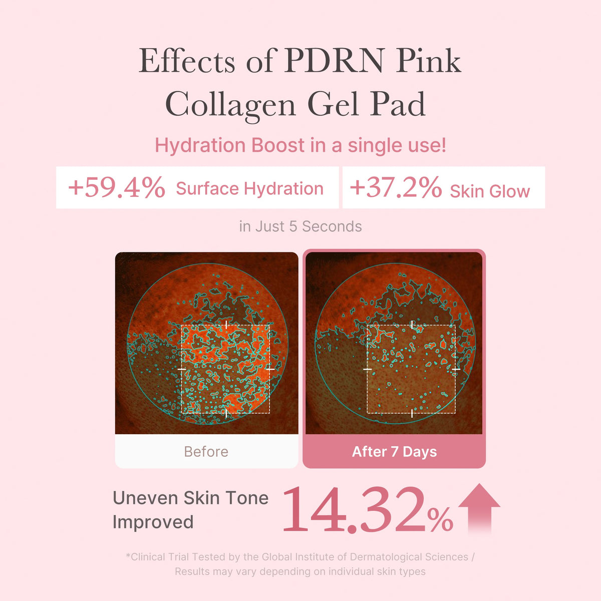 pdrn-pink-collagen-gel-toner-pad-t5 PDRN_04_f9a16a56-8d9e-4c47-a635-ed34ec3ed571.jpg