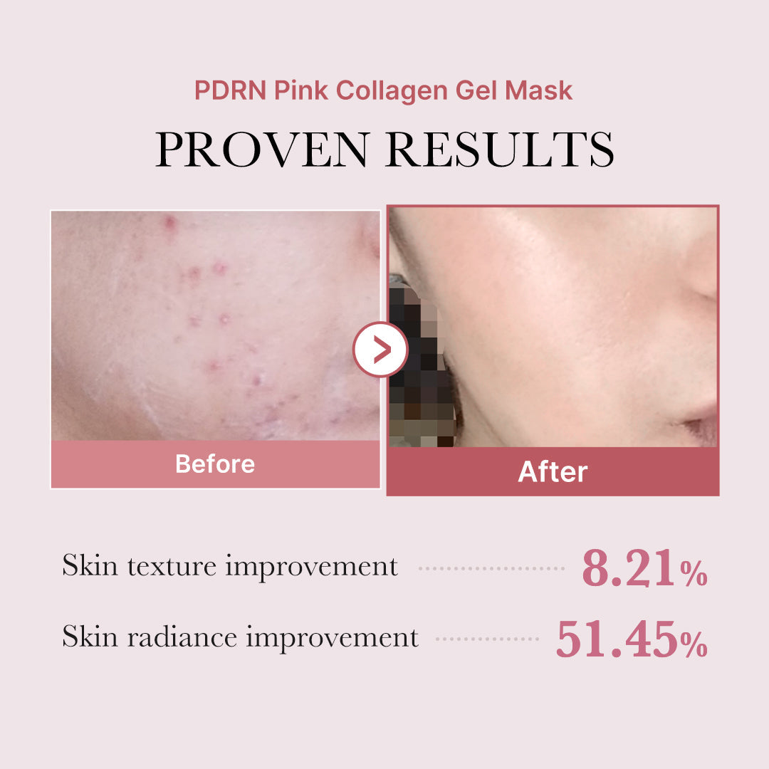 pdrn-pink-glow-full-set-r8 PDRN_12.jpg